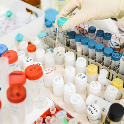 B&B Bio RSV A/B RNA detection by RT-PCR Kit